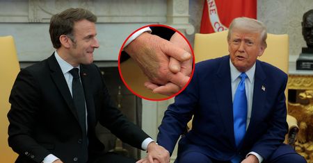 Co się stało? Tajemniczy siniak na dłoni Trumpa