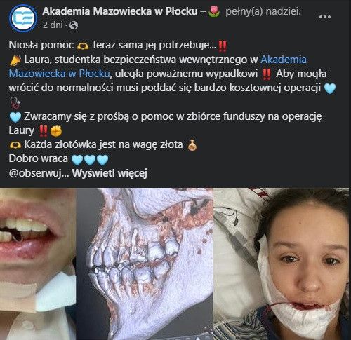 Studentka z Płocka potrzebuje pomocy - uległa poważnemu wypadkowi!