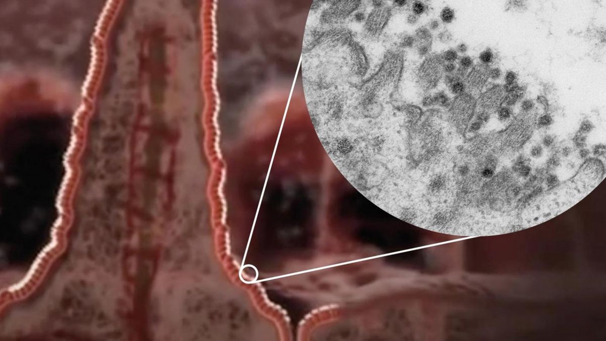 Naukowcy z Holandii odkryli, że koronawius może atakowac jelita i namnażać się w obrębie tego organu