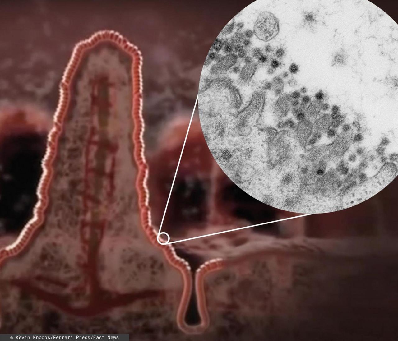 Koronawirus atakuje jelita. Czy może je trwale uszkodzić?