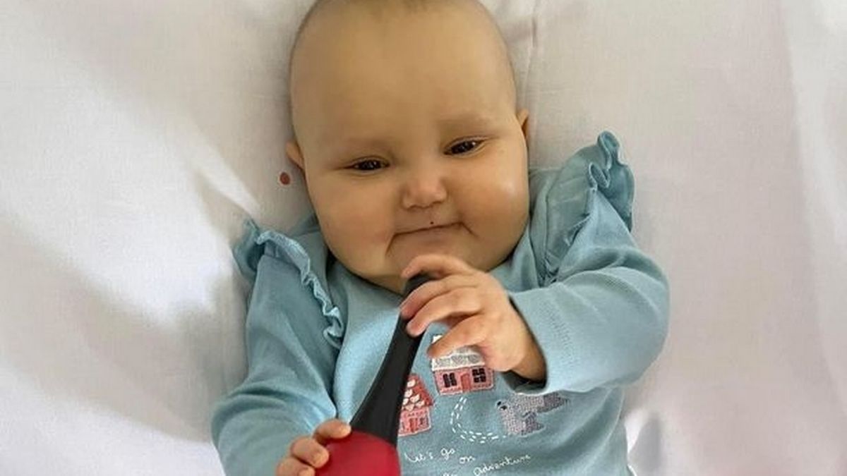 Ava cierpiała na zespół wad wrodzonych