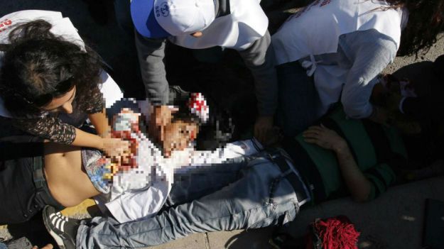 Akcja reanimacyjna na miejscu zdarzenia