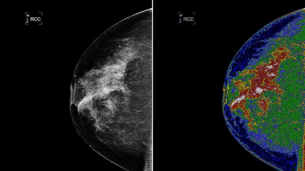 Oprogramowanie NASA do satelitów trafia do medycyny 1