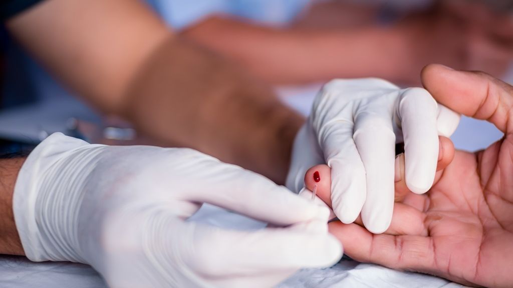 Ostrą chorobą retrowirusową można zakazić się m.in. poprzez kontakt z krwią chorego