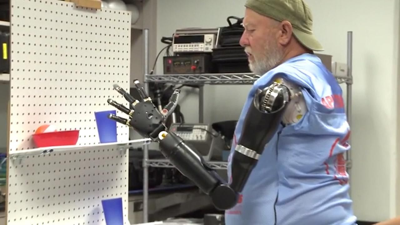 „Cześć, jestem cyborgiem”. Nawet nie wiesz, jak technologia zmieniła Twoje życie 2