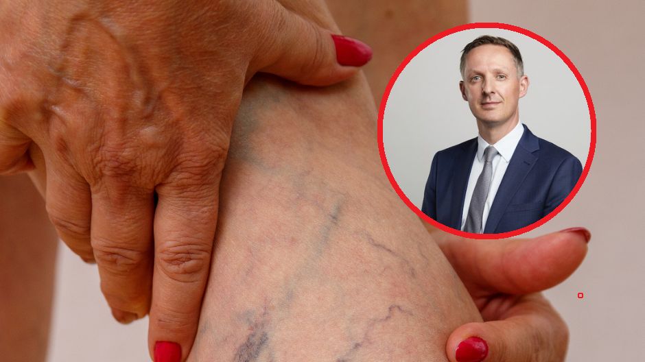 Lekarze ostrzegają przed konsekwencjami siedzenia przez długi czas ze skrzyżowanymi nogami. To może doprowadzić do chorób żył
