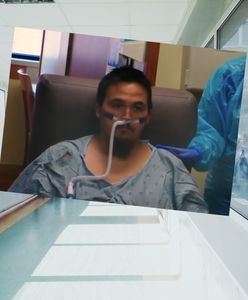 24-latek z USA uwierzył w teorie spiskowe dot. szczepionek. Zmarł przez COVID-19