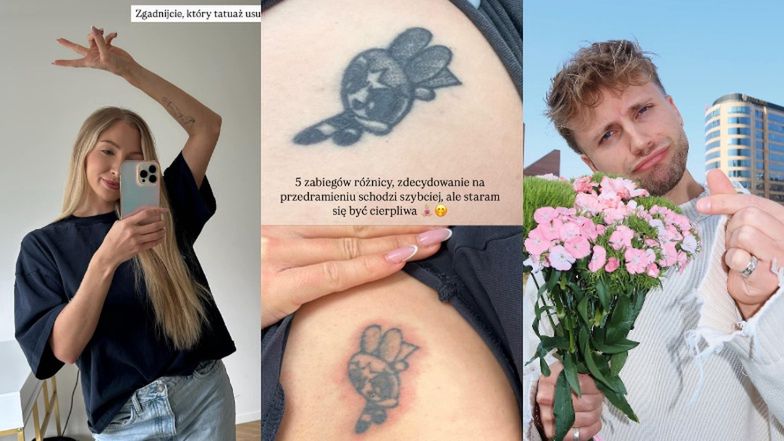 Martirenti usuwa tatuaże