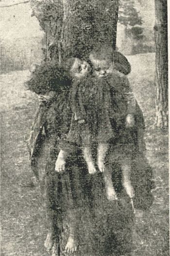 Druga wersja zdjęcia pochodząca z Podręcznika medycyny sądowej dla studentów i lekarzy Wiktora Grzywo-Dąbrowskiego