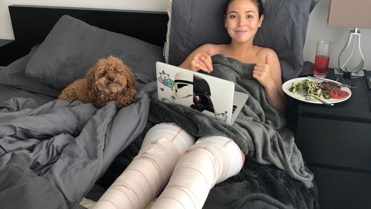 Uważajcie na ogień. Modelka uległa poważnym poparzeniom podczas sesji 1