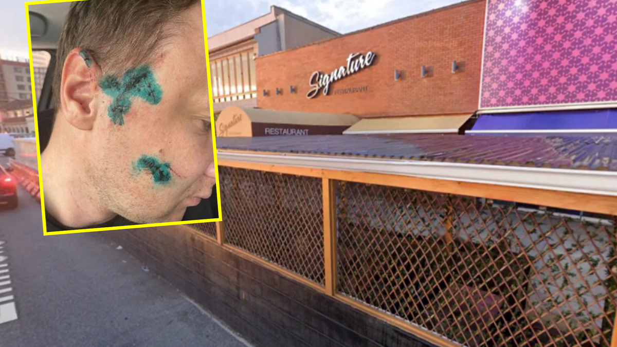 Ukrainiec doznał kilku ran kłutych