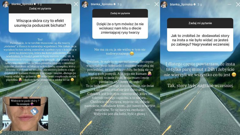Blanka Lipińska ujawnia szczegóły ostatniego liftingu twarzy 