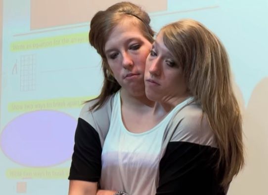 Abby and Brittany Hensel