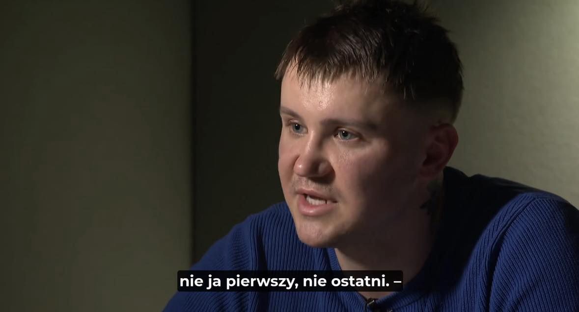 Poddali się przeszczepowi włosów w polecanej klinice