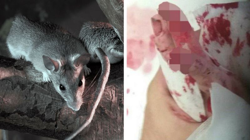 Niepełnosprawna 14-latka została dotkliwie pogryziona przez stado szczurów