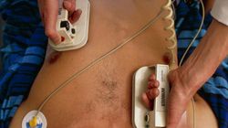 Zapalenie mięśnia sercowego to podstępna choroba. Dr Beata Poprawa mówi, jakie daje objawy ZMS