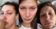 Zapłakana Bella Hadid otwiera się w temacie zdrowia psychicznego: "TAK WYGLĄDA KAŻDY MÓJ DZIEŃ, każda noc"