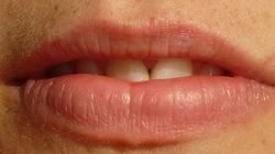 Wirus opryszczki - objawy HSV1 i HSV2, stan utajony, namnażanie, profilaktyka