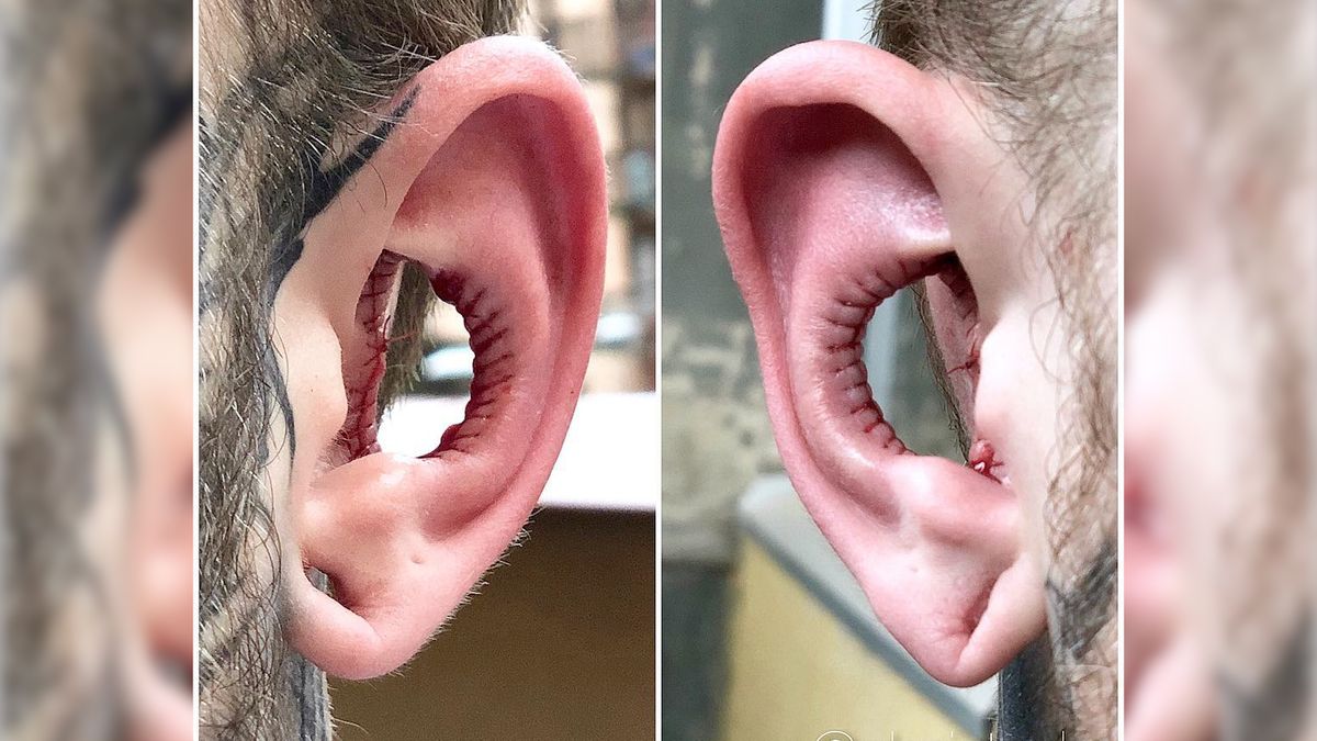 Modyfikacja ciała – kolejny niebezpieczny trend