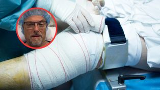Marcin Wrona po operacji kolana. Pokazał, jak wygląda rehabilitacja