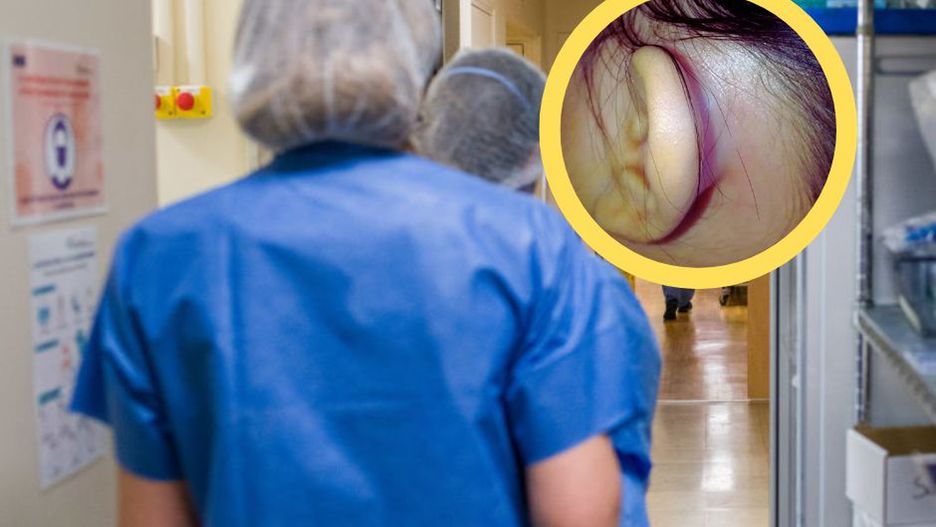 Objaw pojawia się za uchem. Gdy zauważysz, biegnij do lekarza