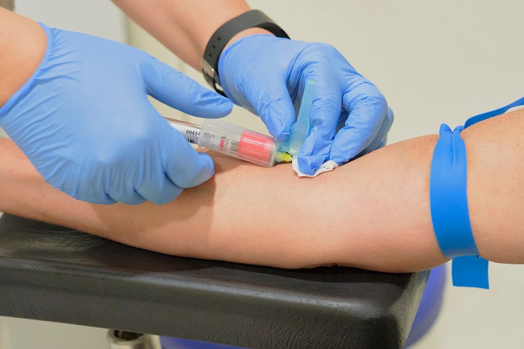 Krzepliwość krwi - zaburzenia, przyczyny, objawy, leczenie