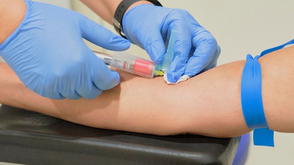 Krzepliwość krwi możemy badać poprzez badanie krwi - koagulogram