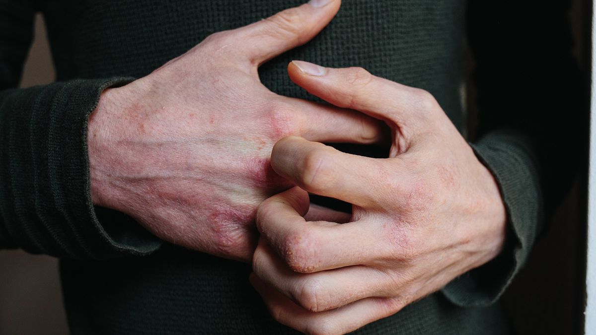 Swędzenie czy guzy pod skórą - może to świadczyć o poważnej chorobie.