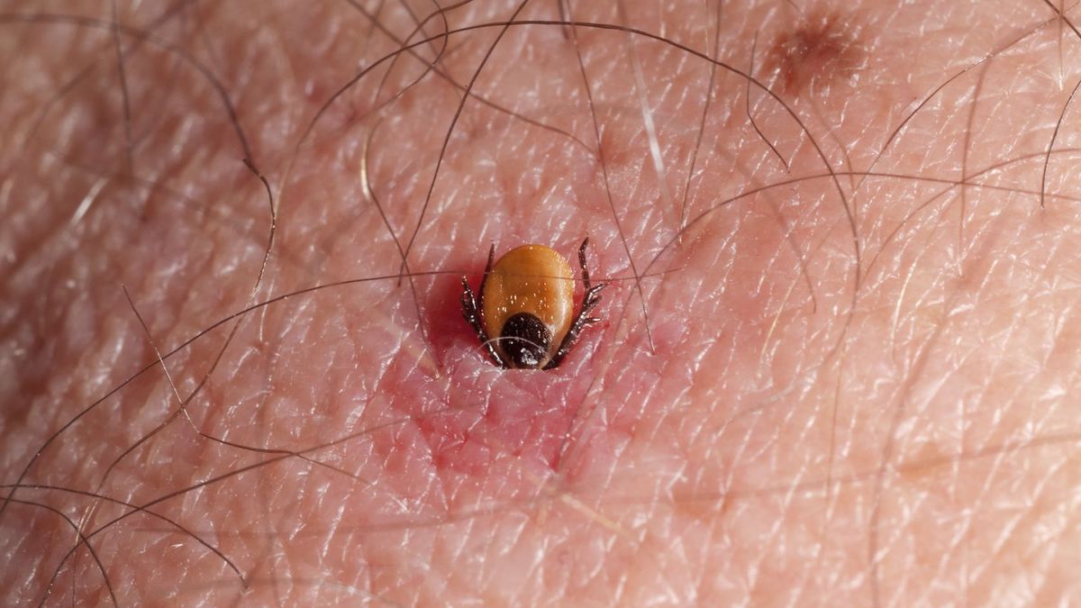 Kleszcze przenoszą bakterię Borrelia