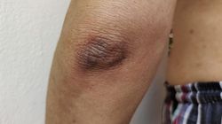 Ostrzegają o cukrzycy, a nawet raku. Takich zmian nie ignoruj