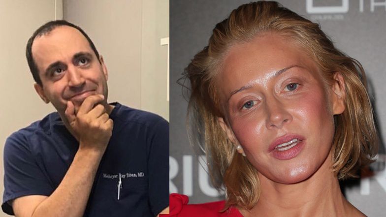 Chirurg plastyczny krytykuje wygląd Katarzyny Warnke: