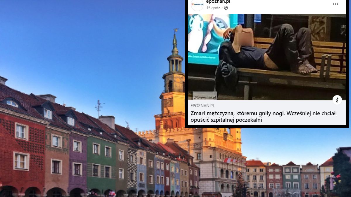 Stopy mężczyzny były w katastrofalnym stanie