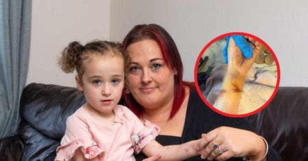 Wyciągnęła rękę, by pogłaskać kota w parku. 3-latka niemal straciła życie przez sepsę