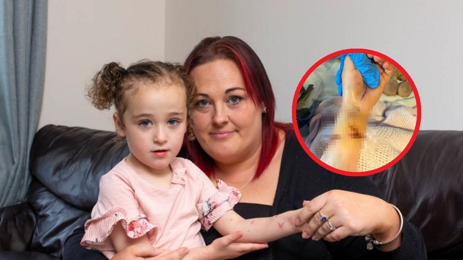 Reakcją organizmu była sepsa