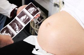 Kosmówka – budowa, funkcje i problemy w ciąży