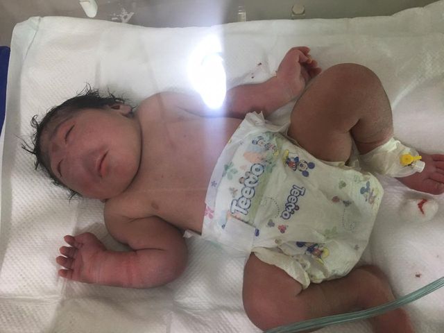 W irackiej Faludży urodziło się dziecko bez nosa