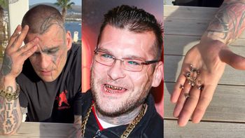 Koniec pewnej epoki: Popek POZBYŁ SIĘ ZŁOTYCH ZĘBÓW! Do twarzy mu w śnieżnobiałej "klawiaturze"? (FOTO)