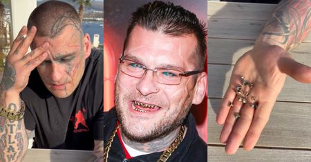 Koniec pewnej epoki: Popek POZBYŁ SIĘ ZŁOTYCH ZĘBÓW! Do twarzy mu w śnieżnobiałej "klawiaturze"? (FOTO)