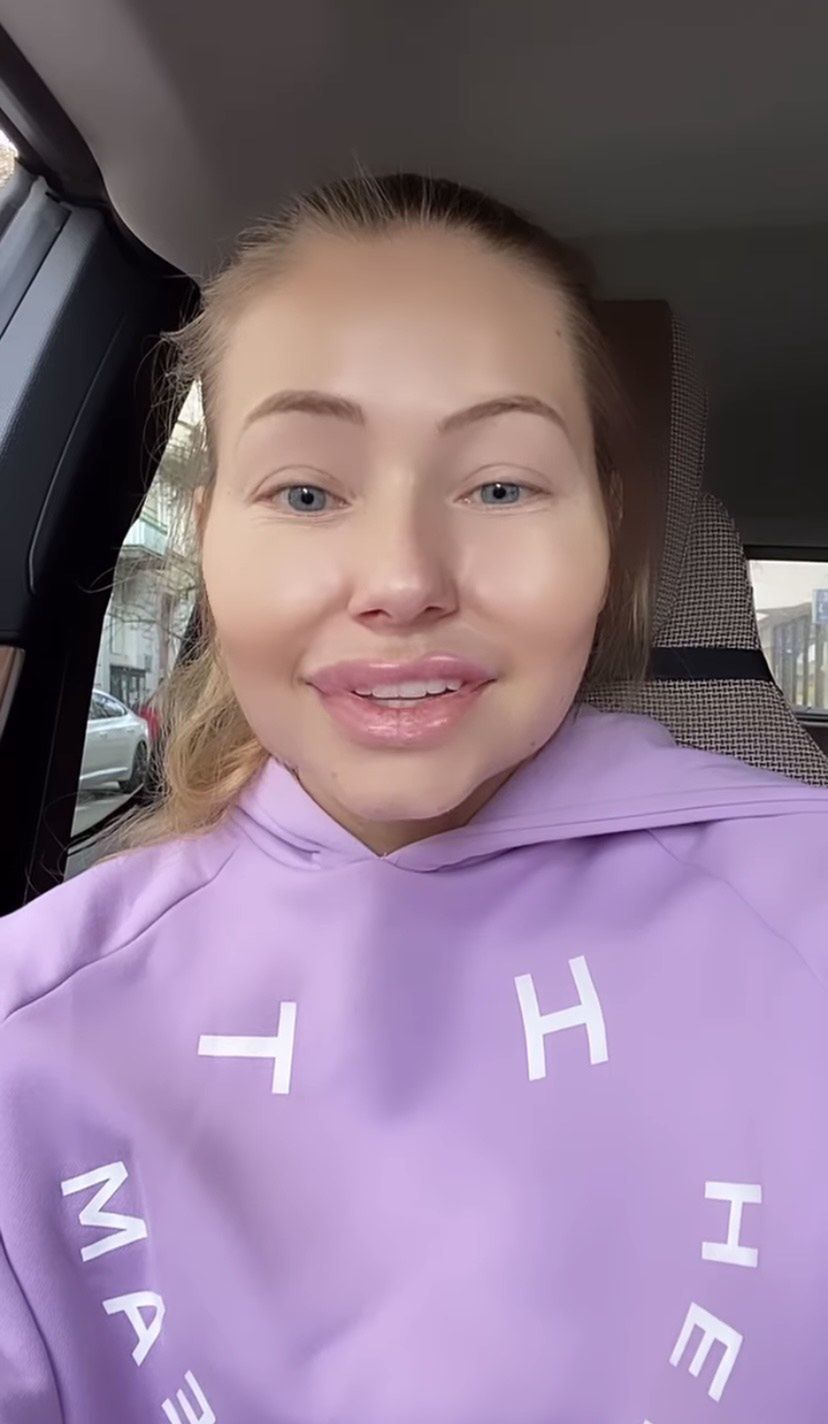 Agata Rubik pokazała, jak wyglądałaby z wypełniaczami w twarzy
