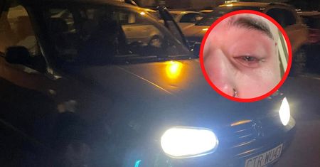 "Rzucił się na mnie". Dał agresorowi 48 godzin