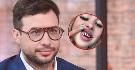 Pacjenci nie mają o tym pojęcia. Polski lekarz o "tureckich zębach"
