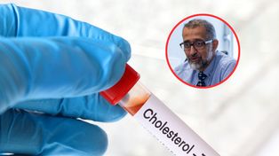 Normy cholesterolu. Kardiolog wskazuje najlepszy moment na jego zbadanie