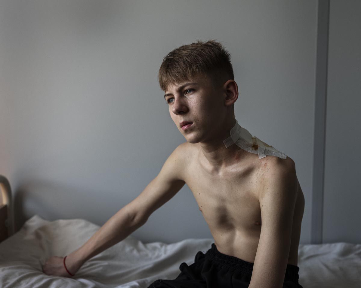 15-letni Igor z Siewierska został raniony podczas ostrzału rakietowego.