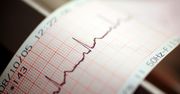 Sztuczna inteligencja wesprze lekarzy. AI "nakarmione" danymi z EKG