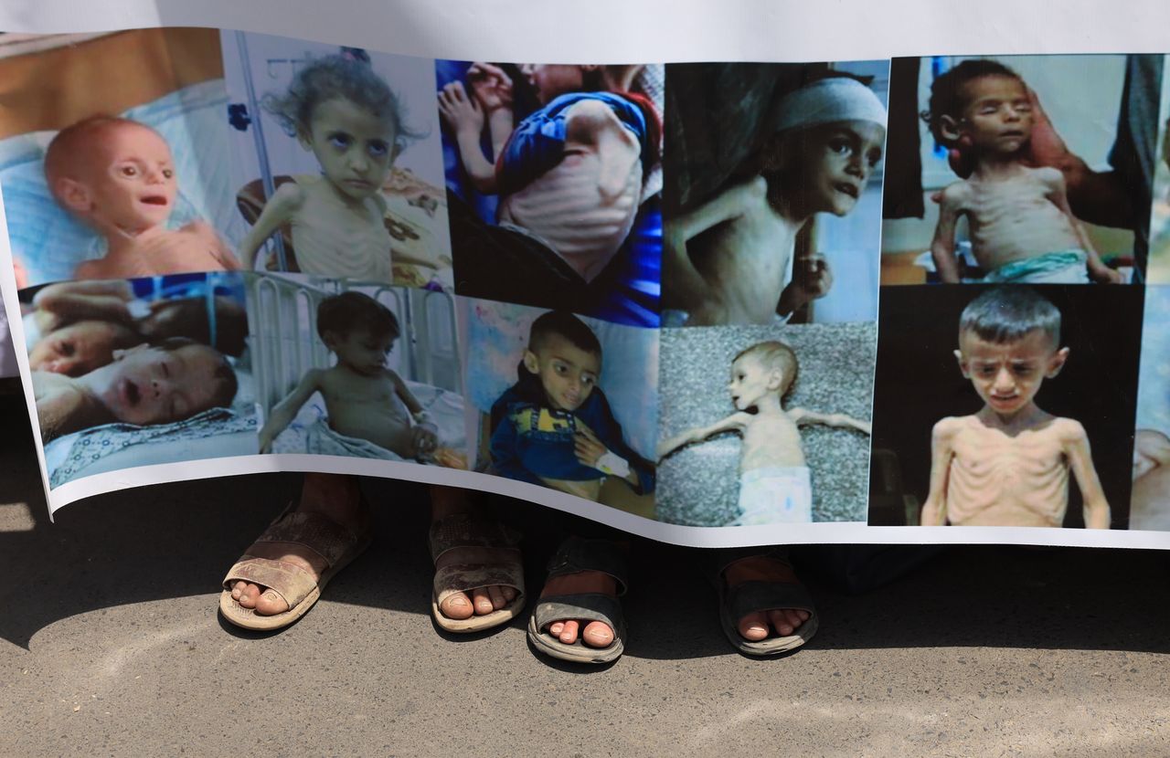 Kryzys humanitarny w Strefie Gazy. Lekarze mówią, co dzieje się na miejscu