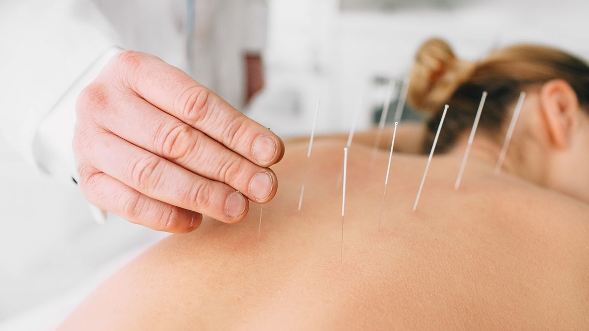 Punkty akupunktury to tak zwane akupunkty,