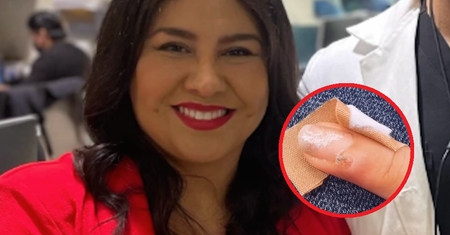 Marzyła o pięknych paznokciach. Przez manicure teraz walczy z rakiem