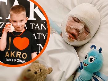 Kazimierz Biskupi: Tata i syn walczą o życie i zdrowie po wybuchu. Ruszyła zbiórka