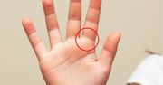 Masz na dłoni taką linię? Sprawdź, co mówi o tobie "pierścień Salomona"