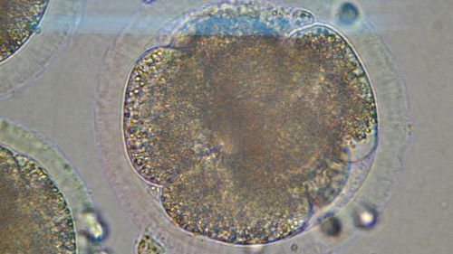 Eksperyment z komórkami macierzystymi - być może rewolucyjny 1